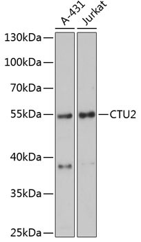 CTU2 Rabbit Polyclonal Antibody