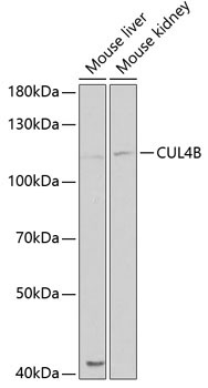 CUL4B Rabbit Polyclonal Antibody