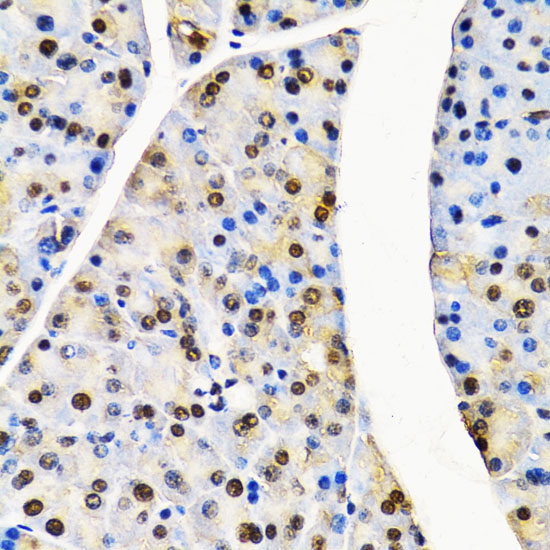CUL4B Rabbit Polyclonal Antibody - Image 3
