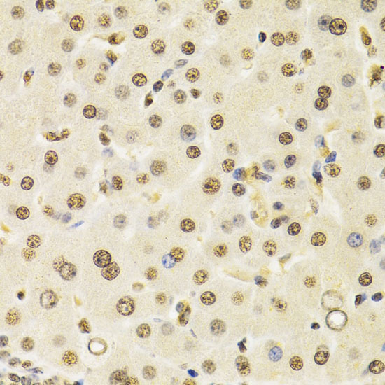 CUL4B Rabbit Polyclonal Antibody - Image 4