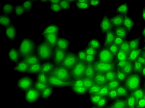 CUL4B Rabbit Polyclonal Antibody - Image 6