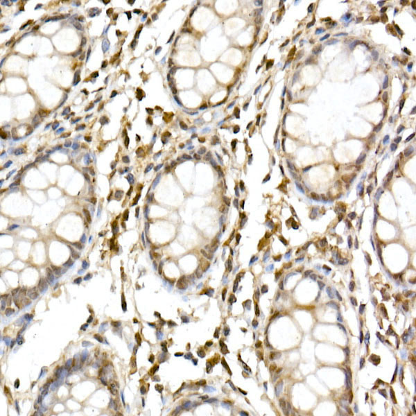 Cullin 1 Rabbit Polyclonal Antibody - Image 2