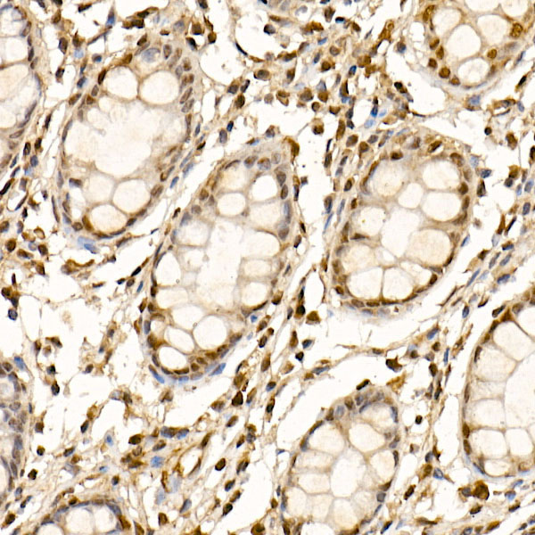 Cullin 1 Rabbit Polyclonal Antibody - Image 2