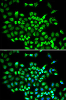 Cullin 2 Rabbit Polyclonal Antibody - Image 2