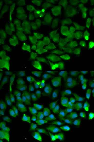 Cullin 3 Rabbit Polyclonal Antibody - Image 2