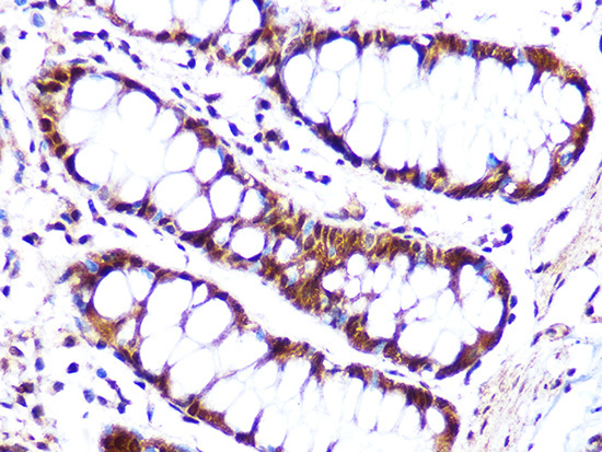 Cullin 4A Rabbit Monoclonal Antibody - Image 2
