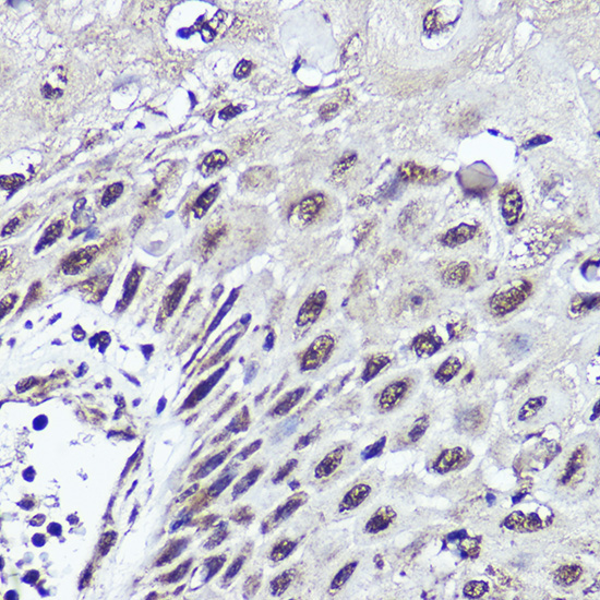 CUX1 Rabbit Polyclonal Antibody - Image 2