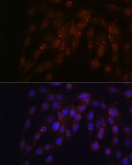 CUX1 Rabbit Polyclonal Antibody - Image 3