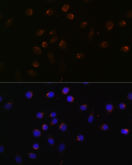 CUX1 Rabbit Polyclonal Antibody - Image 4
