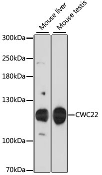 CWC22 Rabbit Polyclonal Antibody