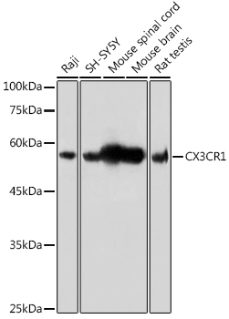 CX3CR1 Rabbit Polyclonal Antibody