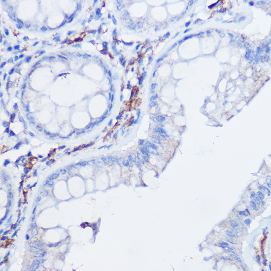 CX3CR1 Rabbit Polyclonal Antibody - Image 2