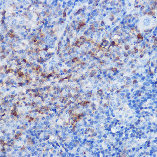 CX3CR1 Rabbit Polyclonal Antibody - Image 3