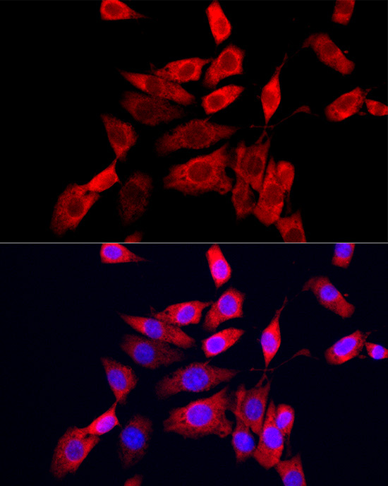 CXCL10/IP-10 Rabbit Polyclonal Antibody - Image 2