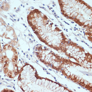 CXCL12 Rabbit Polyclonal Antibody - Image 2