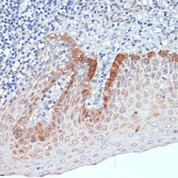 CXCL12 Rabbit Polyclonal Antibody - Image 3