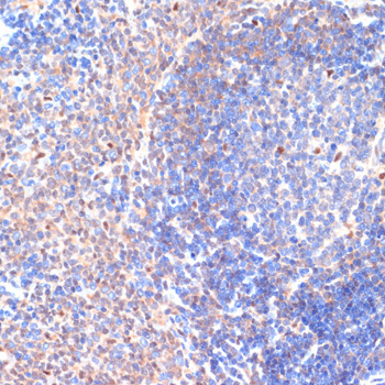 CXCL12 Rabbit Polyclonal Antibody - Image 4