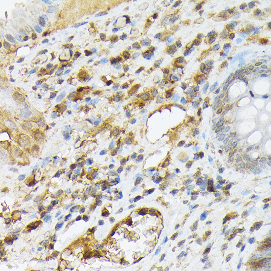 CXCL12 Rabbit Polyclonal Antibody - Image 2