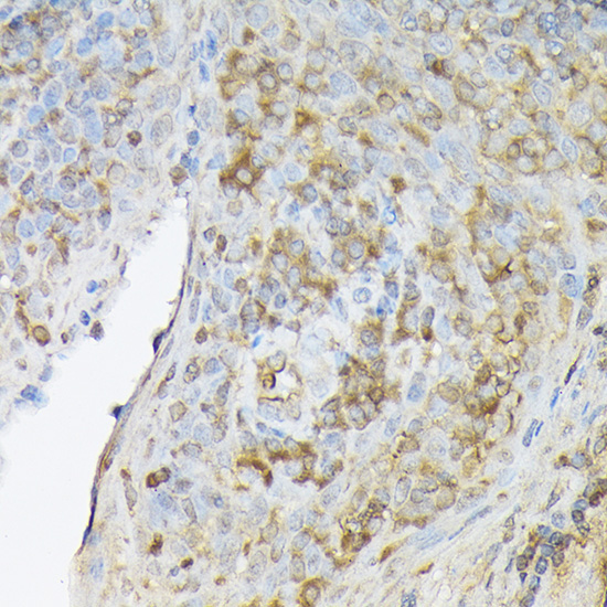 CXCL12 Rabbit Polyclonal Antibody - Image 3