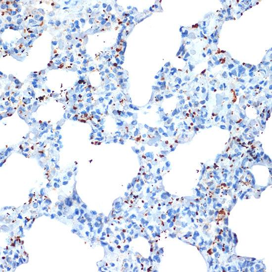 CXCL4/PF4 Rabbit Monoclonal Antibody - Image 2