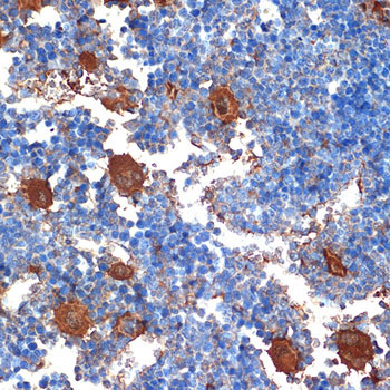 CXCL4/PF4 Rabbit Monoclonal Antibody - Image 3
