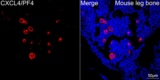CXCL4/PF4 Rabbit Monoclonal Antibody - Image 4