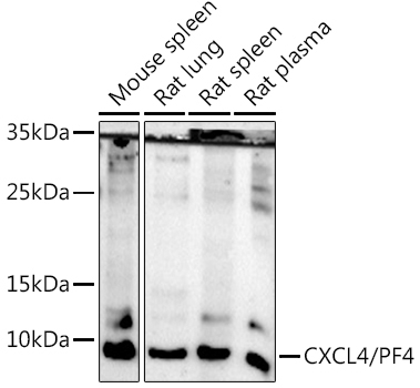 CXCL4/PF4 Rabbit Polyclonal Antibody