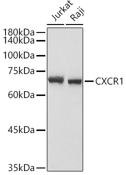 CXCR1 Rabbit Polyclonal Antibody