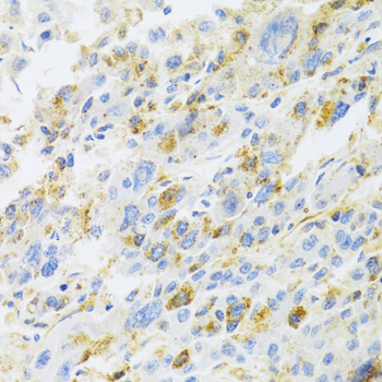CXCR3 Rabbit Polyclonal Antibody - Image 2