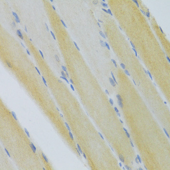 CXCR3 Rabbit Polyclonal Antibody - Image 3