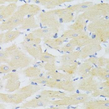 CXCR3 Rabbit Polyclonal Antibody - Image 4