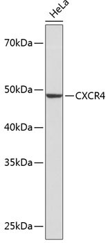 CXCR4 Rabbit Monoclonal Antibody