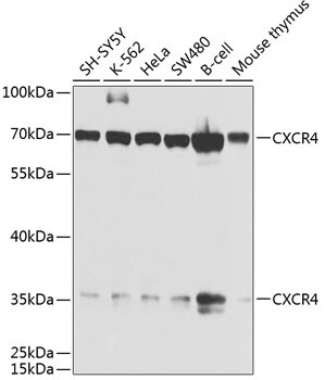 CXCR4 Rabbit Polyclonal Antibody