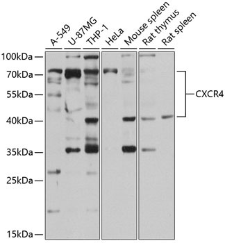 CXCR4 Rabbit Polyclonal Antibody
