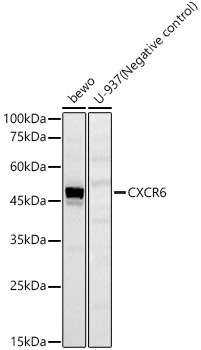 CXCR6 Rabbit Polyclonal Antibody