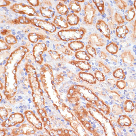 CYB5A Rabbit Polyclonal Antibody - Image 2