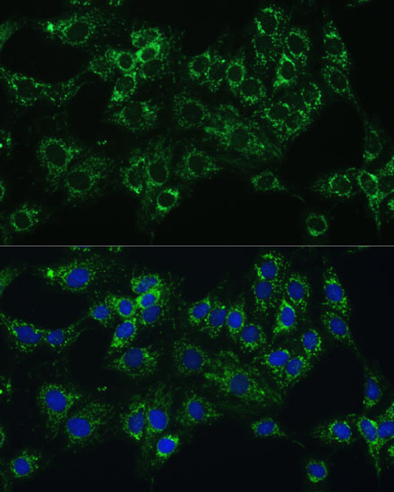 CYB5A Rabbit Polyclonal Antibody - Image 4