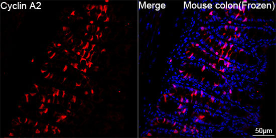 Cyclin A2 Rabbit Monoclonal Antibody - Image 5