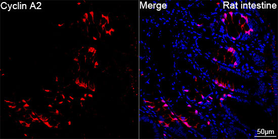 Cyclin A2 Rabbit Monoclonal Antibody - Image 11