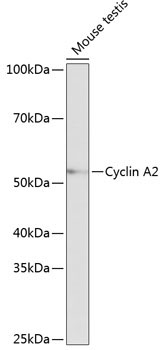 Cyclin A2 Rabbit Monoclonal Antibody - Image 12