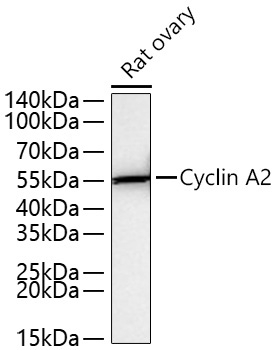 Cyclin A2 Rabbit Monoclonal Antibody - Image 13