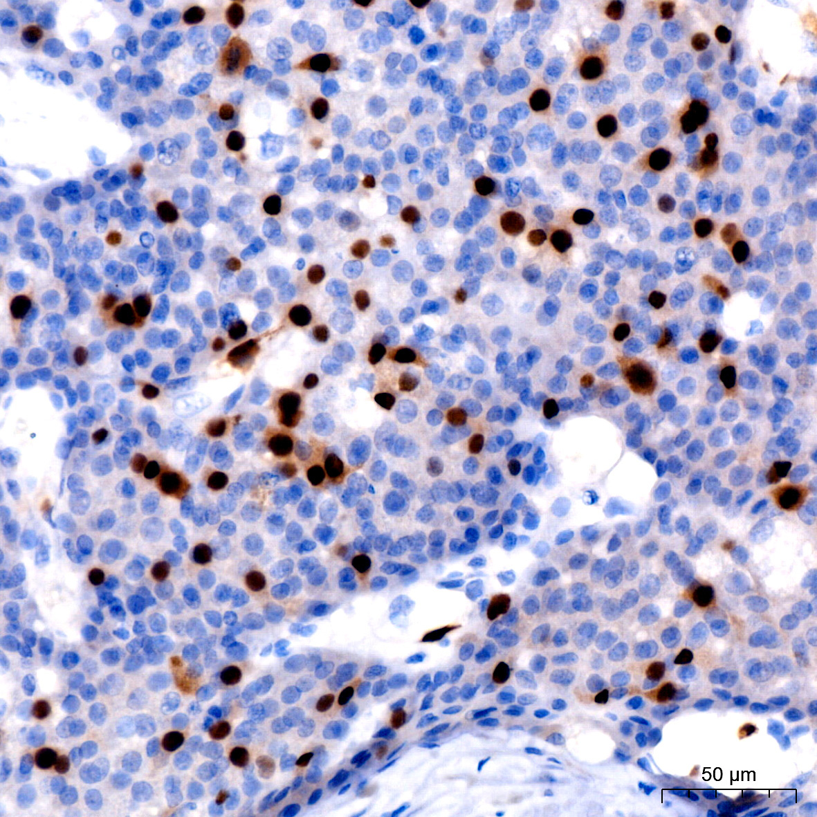 Cyclin A2 Rabbit Monoclonal Antibody - Image 17