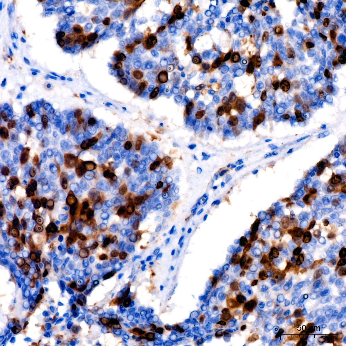 Cyclin A2 Rabbit Monoclonal Antibody - Image 18