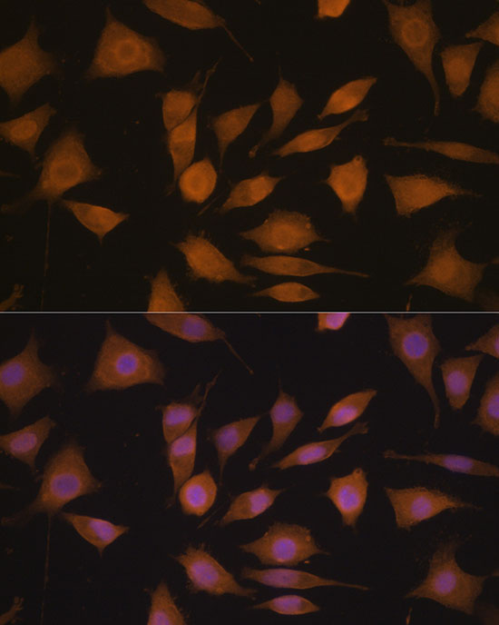 Cyclin A2 Rabbit Polyclonal Antibody - Image 2