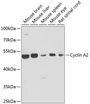 Cyclin A2 Rabbit Polyclonal Antibody