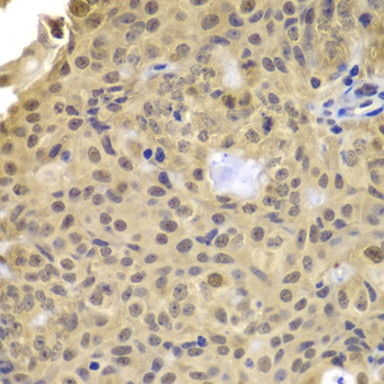 Cyclin A2 Rabbit Polyclonal Antibody - Image 2