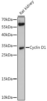 Cyclin D1 Rabbit Polyclonal Antibody