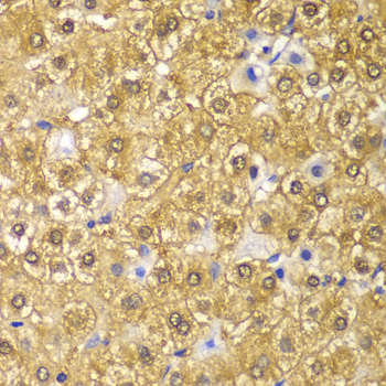 Cyclin D1 Rabbit Polyclonal Antibody - Image 2