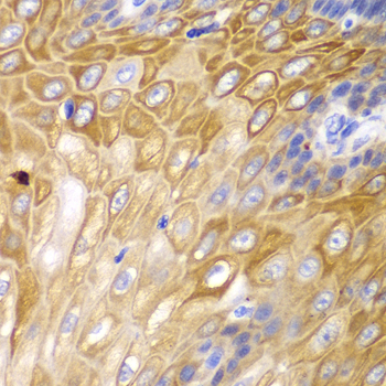 Cyclin D1 Rabbit Polyclonal Antibody - Image 3