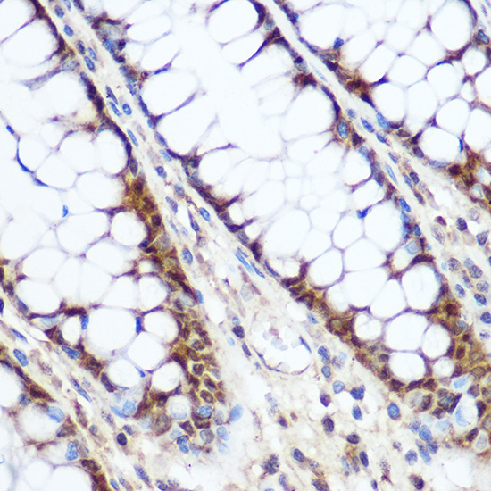 Cyclin D1 Rabbit Polyclonal Antibody - Image 3